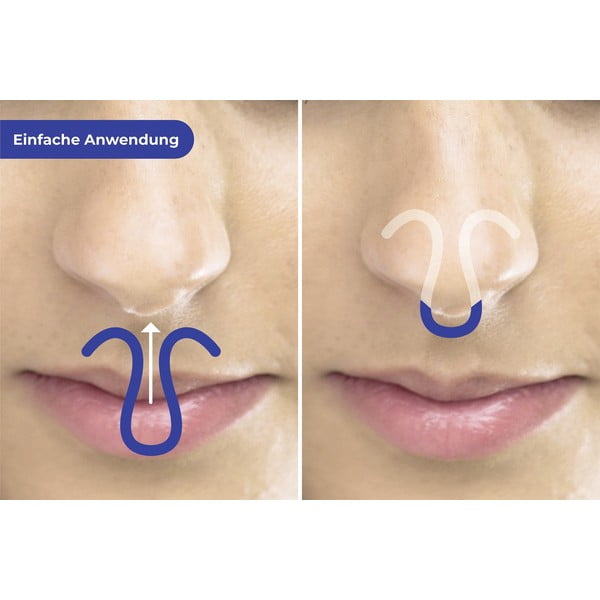 Klipy proti chrápání v sadě 3 ks – Maximex-image-1